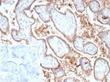 PD-L1 Antibody / B7-H1 / CD274