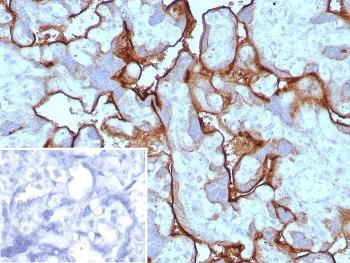 PD-L1 Antibody / B7-H1 / CD274
