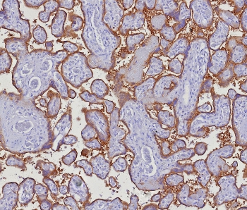 PD-L1 Antibody / B7-H1 / CD274