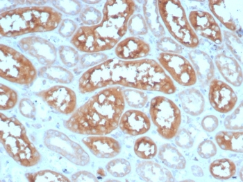 ADCY8 Antibody / Adenylyl cyclase 8