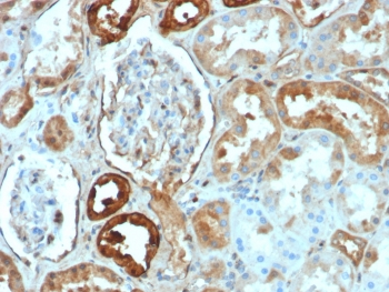 Calbindin Antibody / CALB1