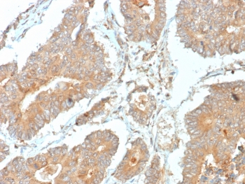 NECAB1 Antibody / N-terminal EF-hand calcium binding protein 1