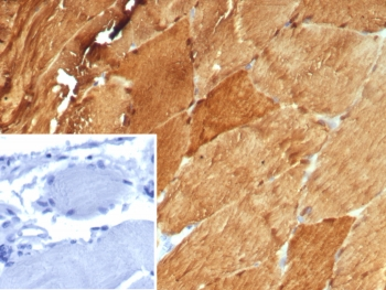 CA3 Antibody / Carbonic Anhydrase III
