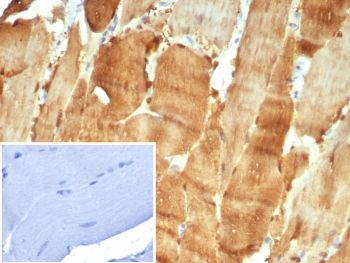 CA3 Antibody / Carbonic Anhydrase III