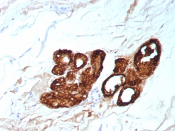 GCDFP-15 Antibody / PIP / Prolactin-Induced Protein