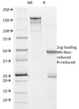 BRAF V600E Antibody