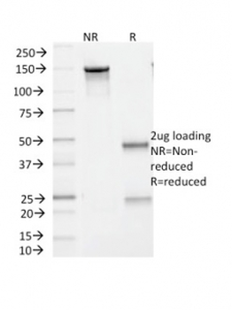 BRAF V600E Antibody