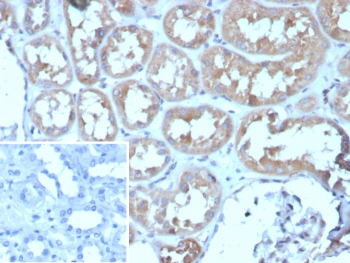 ADCY8 Antibody / Adenylyl cyclase 8