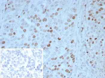 PAX4 Antibody