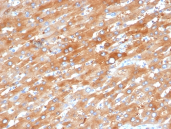 EPHB4 Antibody / EPH Receptor B4
