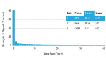 GTF2I Antibody / TFII-I