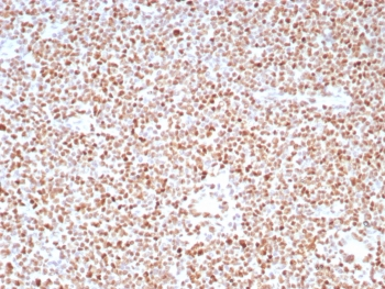 PMS2 Antibody / Post Meiotic Segregation Increased 2