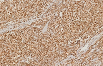 PMS2 Antibody / Post Meiotic Segregation Increased 2