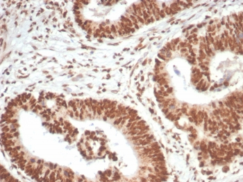 WT1-associated protein Antibody / WTAP