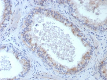 ROS1 Antibody