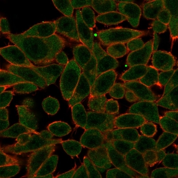 PRDM1 Antibody / BLIMP1