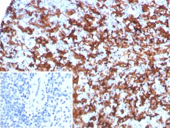 IBA1 Antibody / AIF-1