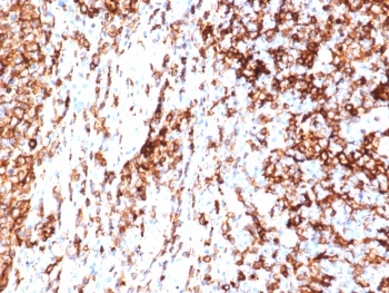 HLA-DR Antibody (MHC II)