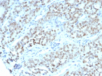 BTBD9 Antibody / BTB/POZ domain-containing protein 9