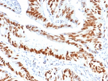 MCM3 Antibody