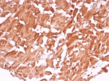 VEGF Antibody / Vascular Endothelial Growth Factor