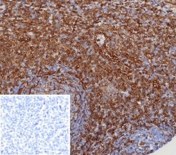 STING1 Antibody / TMEM173 / ERIS / MITA