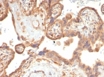 VEGF Antibody / Vascular Endothelial Growth Factor