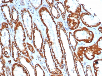 SDHA Antibody