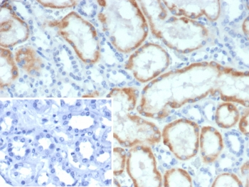 Mineralocorticoid Receptor Antibody / MR / NR3C2