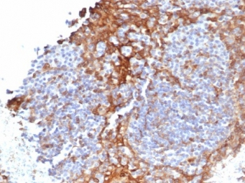 STING1 Antibody / TMEM173 / ERIS / MITA