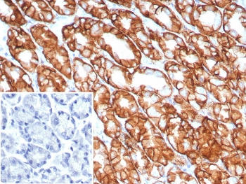 Claudin18.2 Antibody