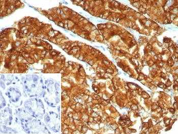 Claudin18.2 Antibody