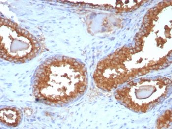 PSAP Antibody / Prostate Specific Acid Phosphatase