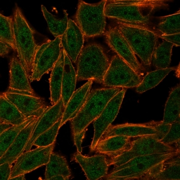 ZXDC Antibody / ZXD-like zinc finger protein