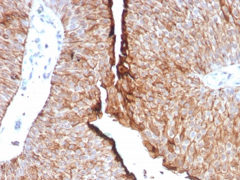Uroplakin 1B Antibody / UPK1B