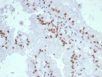 MLH1 Antibody / MutL Homolog 1