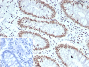 MLH1 Antibody / MutL Homolog 1