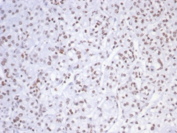 SMARCAL1 Antibody