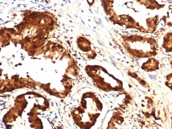 IDH1 Antibody / Isocitrate Dehydrogenase (R132H mutant)