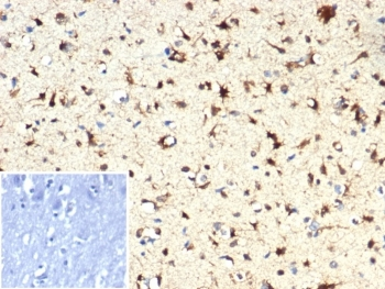 IDH1 Antibody / Isocitrate Dehydrogenase (R132H mutant)