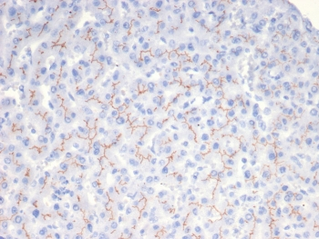 BSEP Antibody / Bile Salt Export Pump / ABCB11