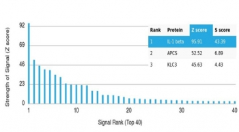 IL1 beta Antibody / IL1B
