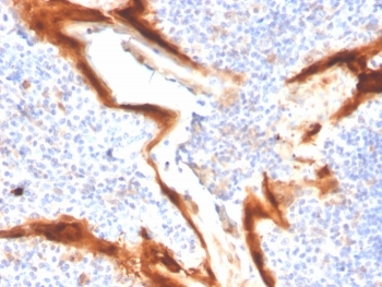 IL1RA Antibody / Interleukin-1 Receptor Antagonist / IL1RN