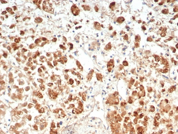 IL18R1 Antibody / Interleukin 18 receptor alpha