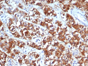 IL18R1 Antibody / Interleukin 18 receptor alpha