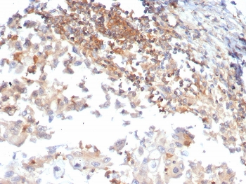 hCG Receptor / LH Receptor Antibody