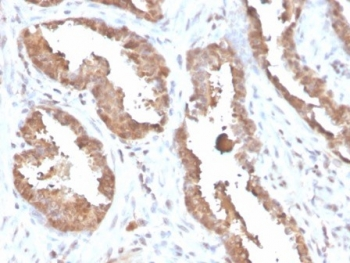 MIF Antibody / Macrophage migration inhibitory factor