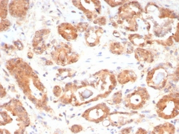 MIF Antibody / Macrophage migration inhibitory factor