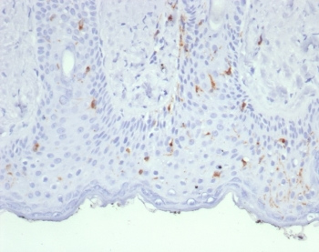 Langerin Antibody / CD207