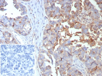 MX1 Antibody / MxA / Myxovirus resistance protein 1